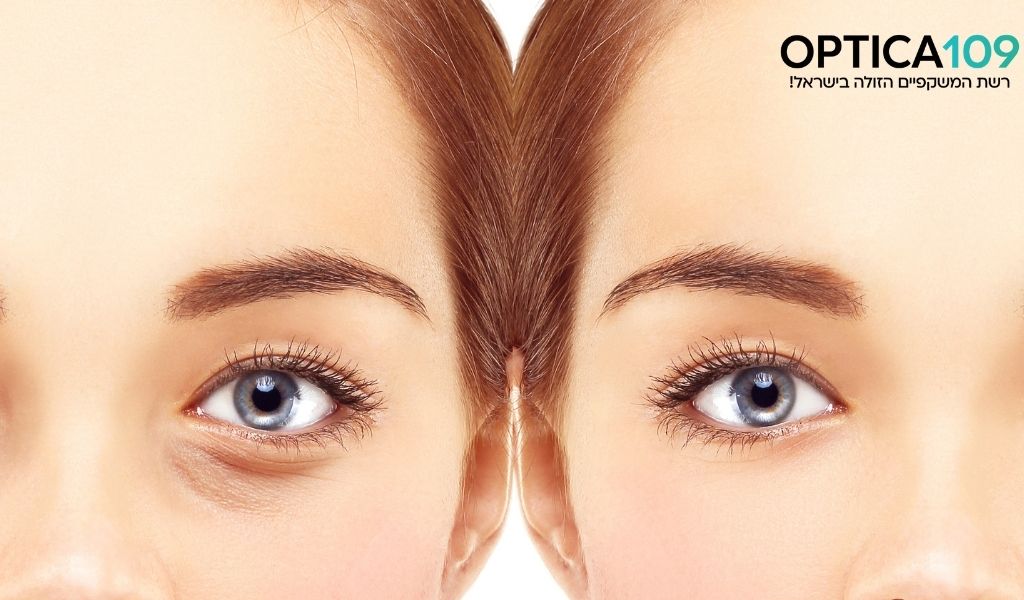 צניח ת עפעף